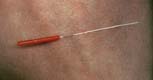 No. 1 Acupuncture Needle